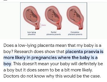 SINO PO DITO YUNG NAKA EXPERIENCE NG LOW LYING PLACENTA NA BABY BOY ANG GENDER.