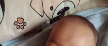 May nakaumbok sa gilid ng ulo ni baby