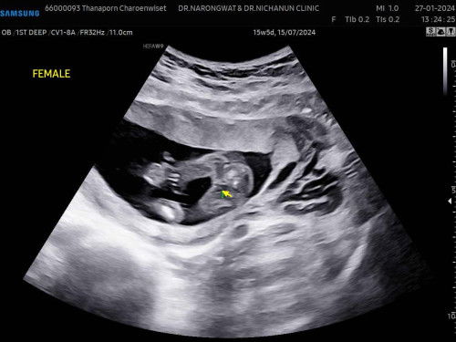 รู้เพศแล้วค่า คนโตผู้ชายคนเล็กผู้หญิงสมใจแม่❤️