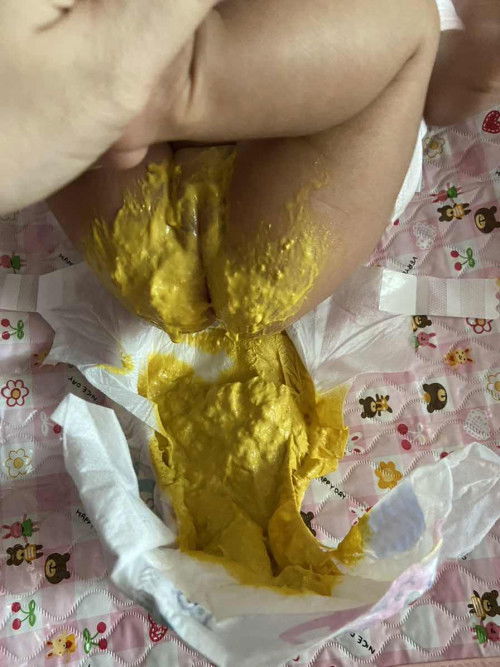 Najis baby 2 bulan susu badan sahaja