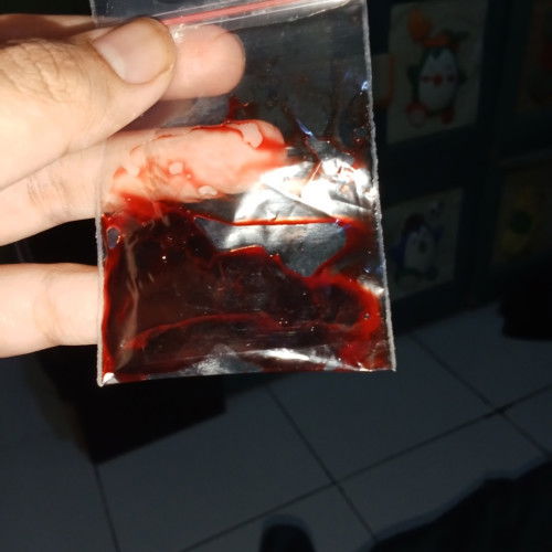 Seputar kehamilan Absortus iminnest