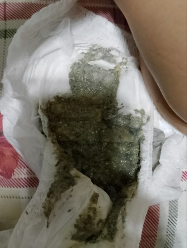 mga mi normal lang ba tong poo ng baby ko?