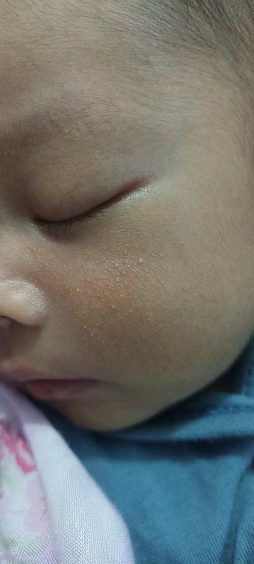 Bintik kecil merah