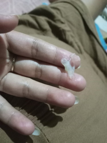 Keputihan kah