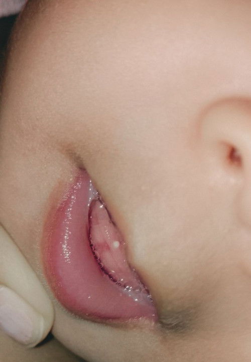 Teething or  what??????????