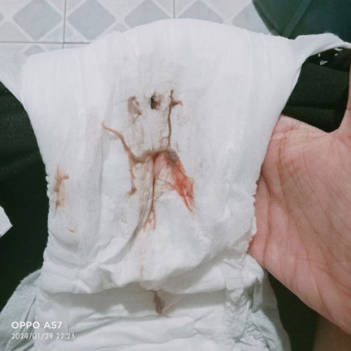 โดนกระตุ้น