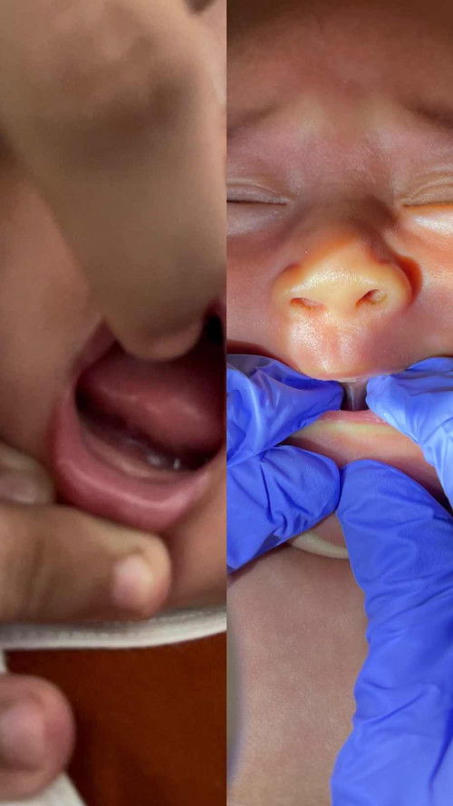 Bayi 2 Bulan 24 hari