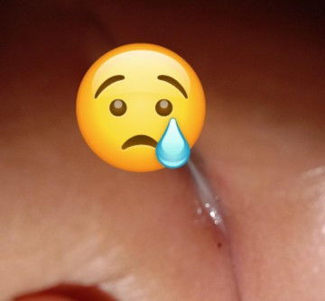 anak 1 tahun keputihan