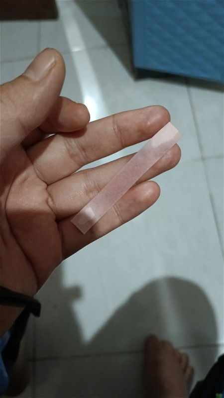 Keluar Cairan Stelah Buang Air Kecil