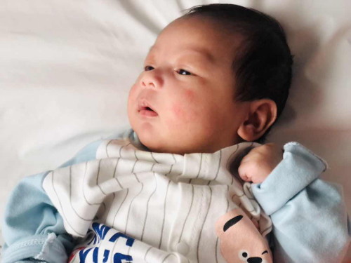 หน้าน้องเป็นผื่นและแดงจั้มๆ เป็นอะไรหรอคะ