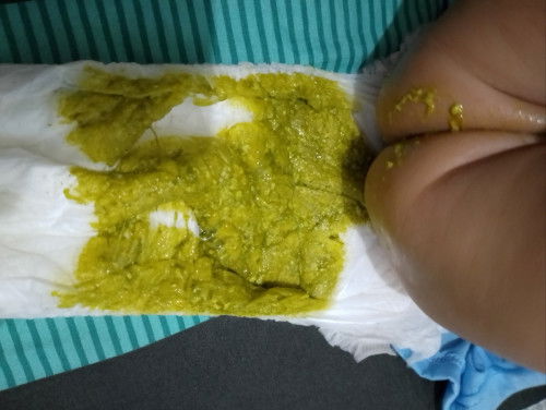 Warna BAB bayi 5 bulan