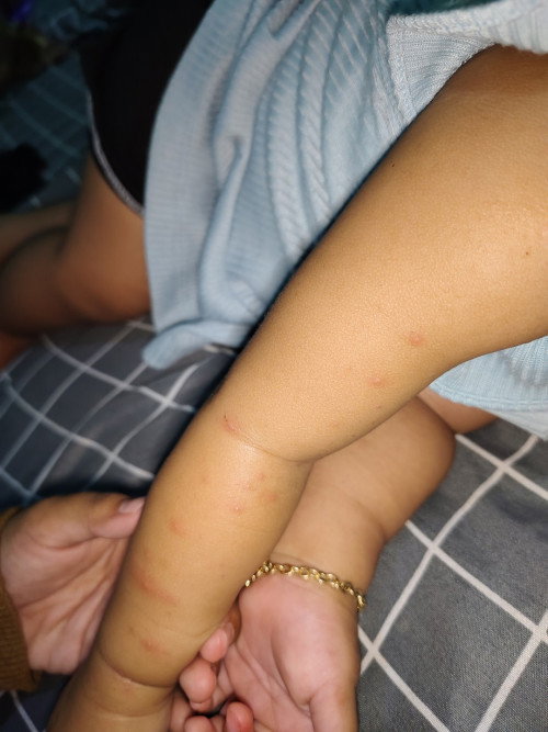 Bayi 8 bulan