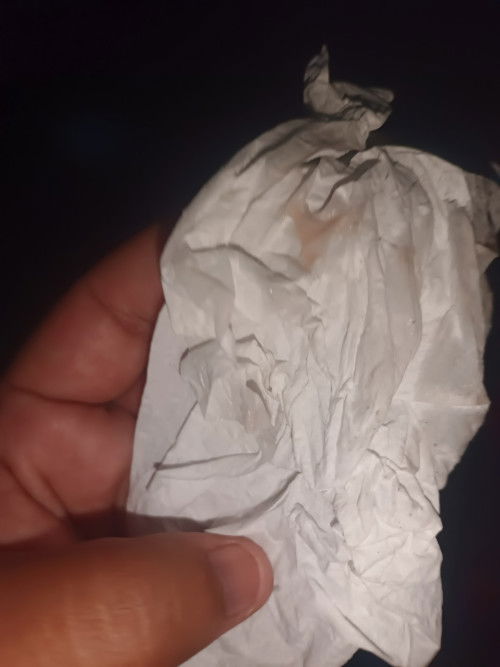 มูกแบบนี้ควรไปหาหมอเลยมั้ยค่ะ ไม่มีอาการอะไรเลยย