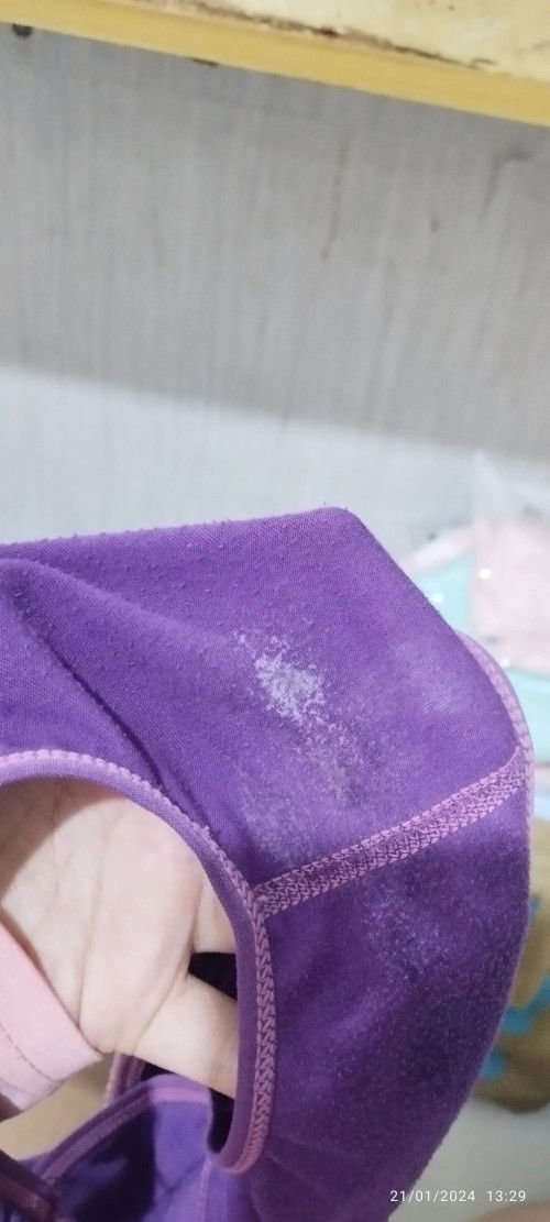 Keputihan 31 week normal gaakk?