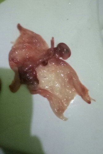 Miscarriage po ba ito or discharge?
i'm 2 weeks delay po