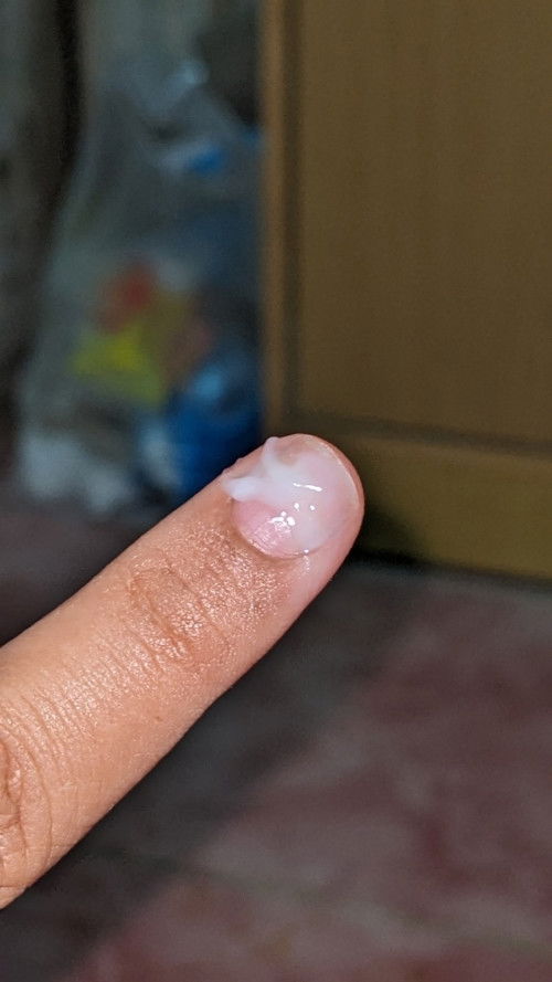 KEPUTIHAN PUTIH SUSU