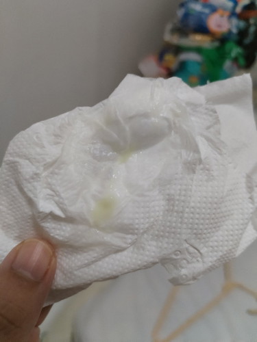 38 weeks with discharge