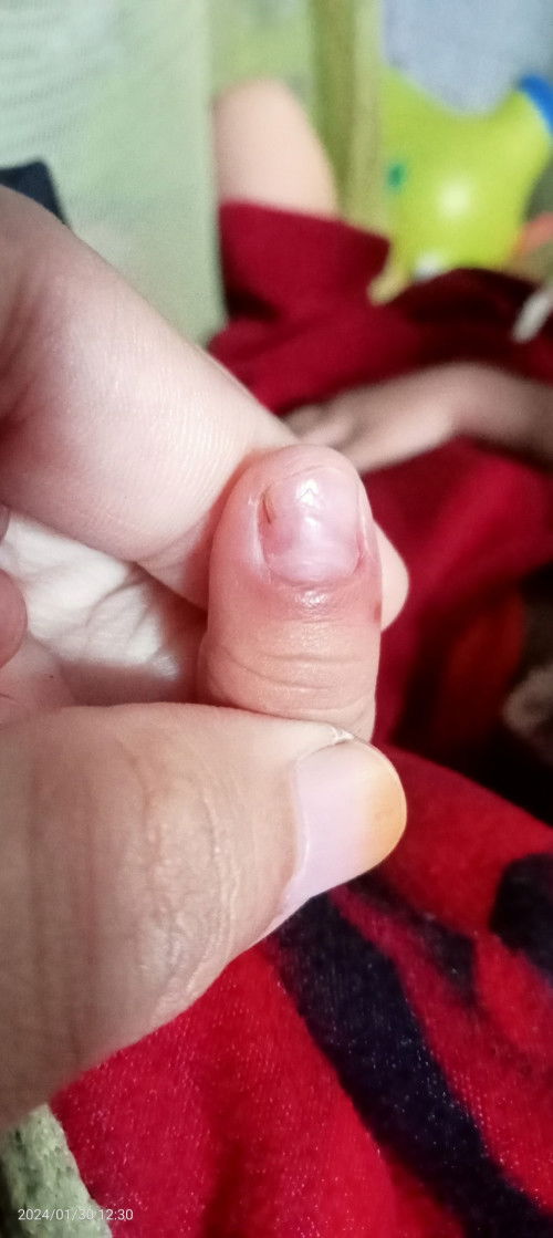 Kuku anak bermasalah