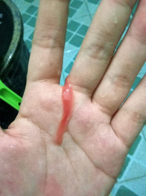 HPL tgl 27 keluar lendir darah