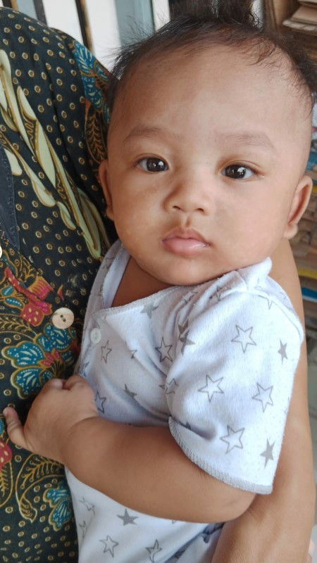 Bercak putih diwajah bayi bahaya atau tidak?