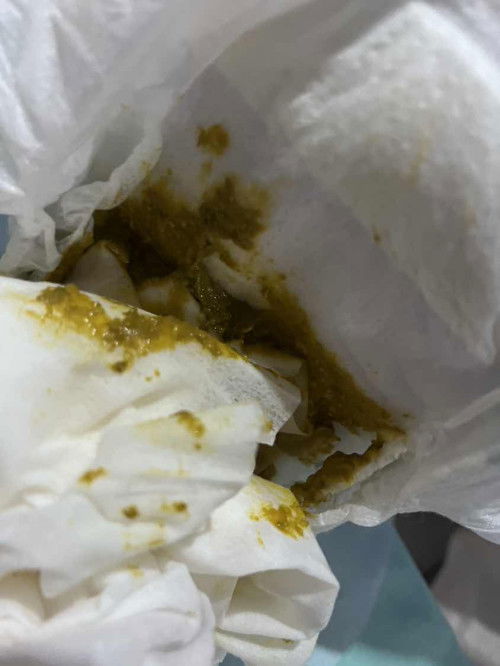 Bayi menagis tiap kali meneran najis