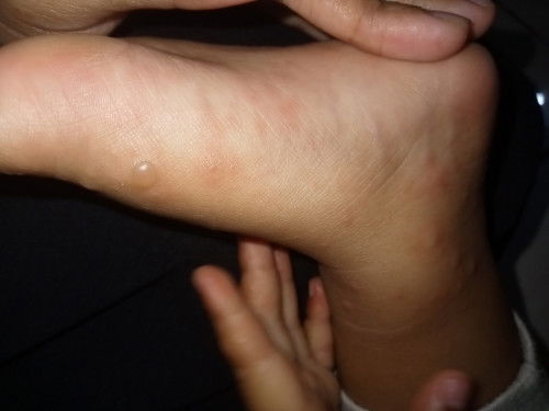 Kalo kaya gini obatnya apa bund ??