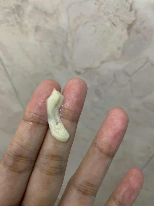 Keputihan seperti susu 27weeks