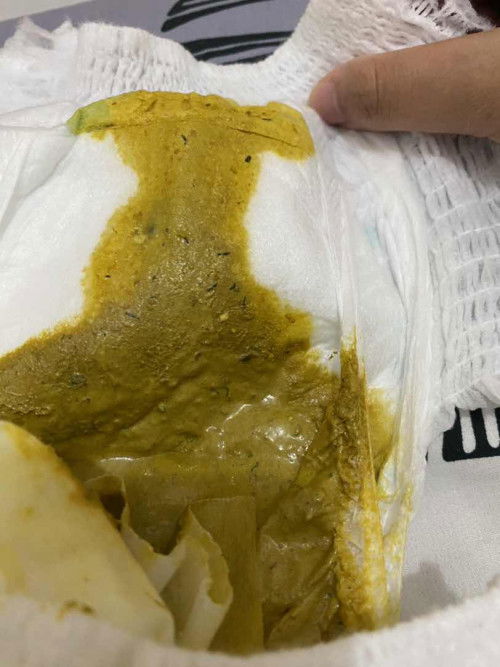 Bab bayi ada benda kecil” warna hitam