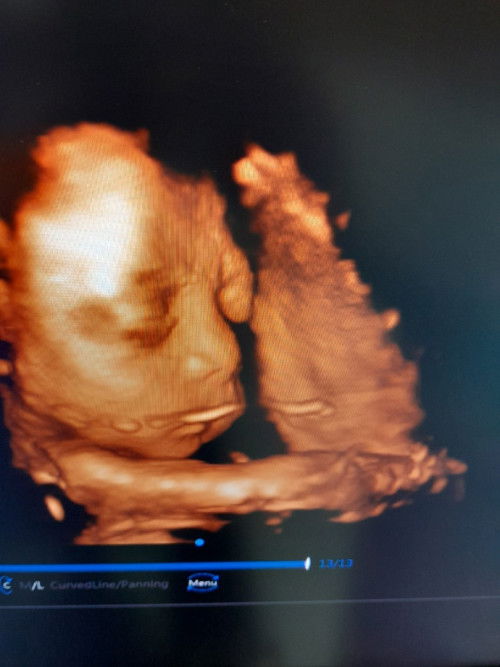 ทีม18มีนาคม