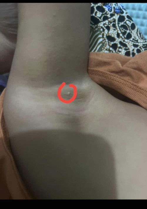 normal ke atau tidak