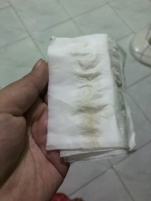 Usia 26w ini flex atau keputihan ya bun?