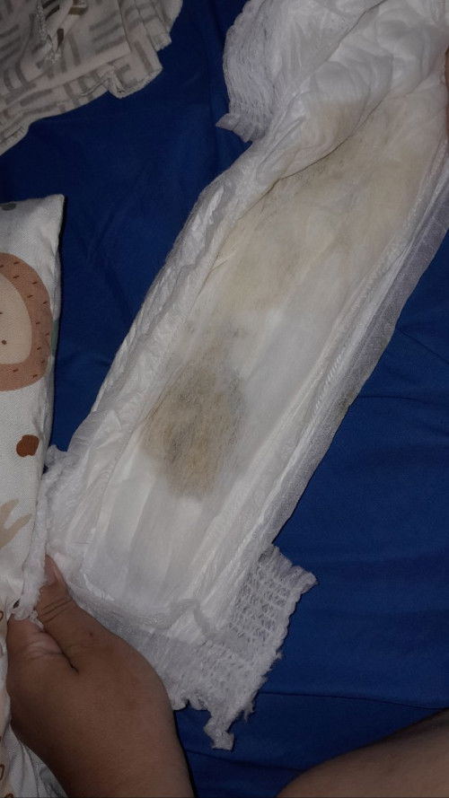 Kencing bayi Berlendir