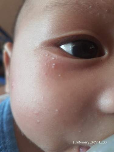 bby 3months