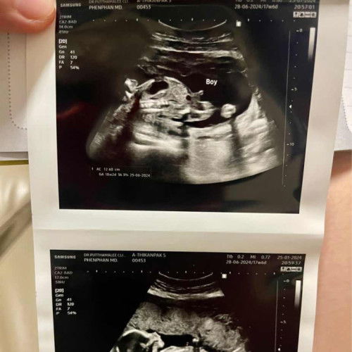 มาอวดเบบี้ปีมังกรทองกันค่ะ กี่weeks กันบ้างแล้วคะ เริ่มตอดๆดิ้นๆหรือยัง 🐲🐉❤️