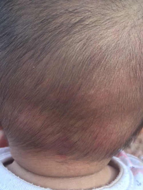 แพ้สบู่เหลวรึเปล่า?