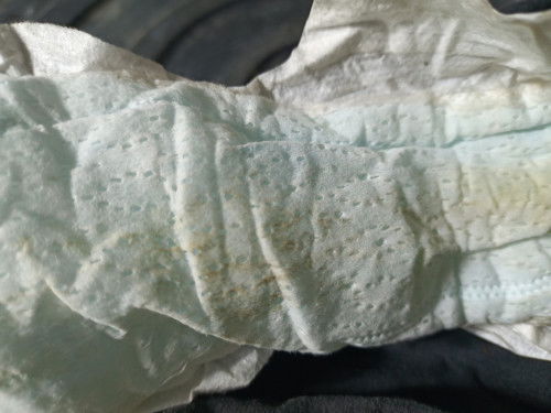 มีเลือดสีน้ำตาล 37+6