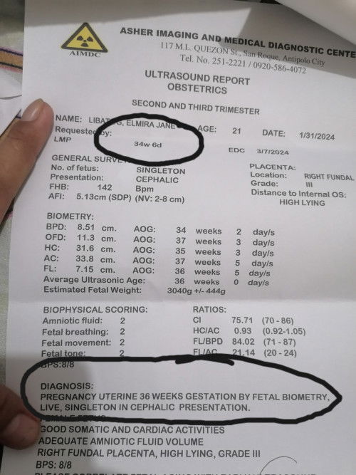 Edd result