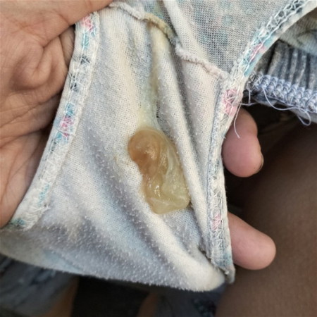 Malapit napo bakong manganak
