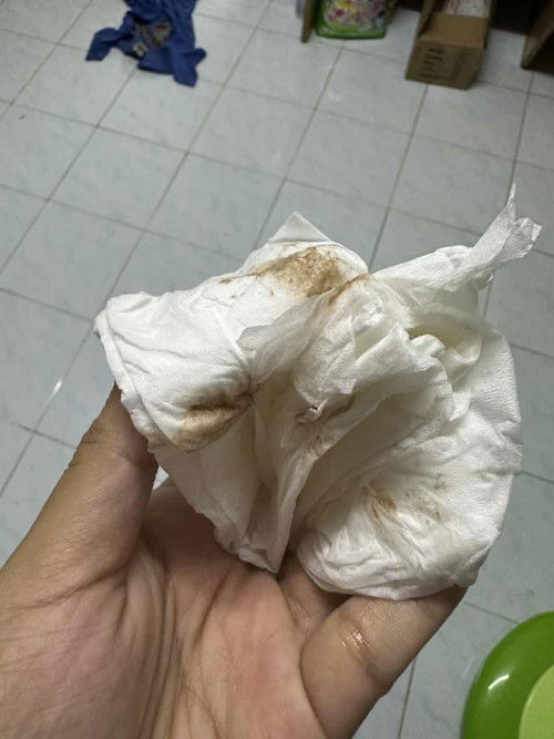 แบบนี้ปกติมั้ยคะ👇🏻👇🏻