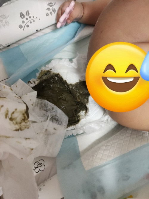 Is this baby poop colour normal ?