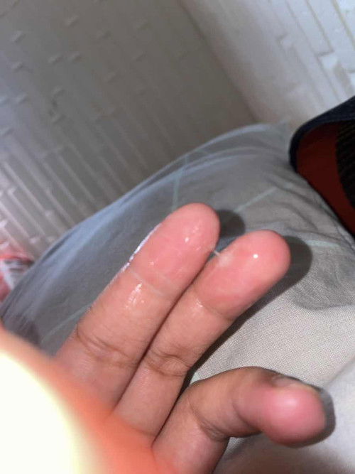 Keputihan ke atau air ketuban?