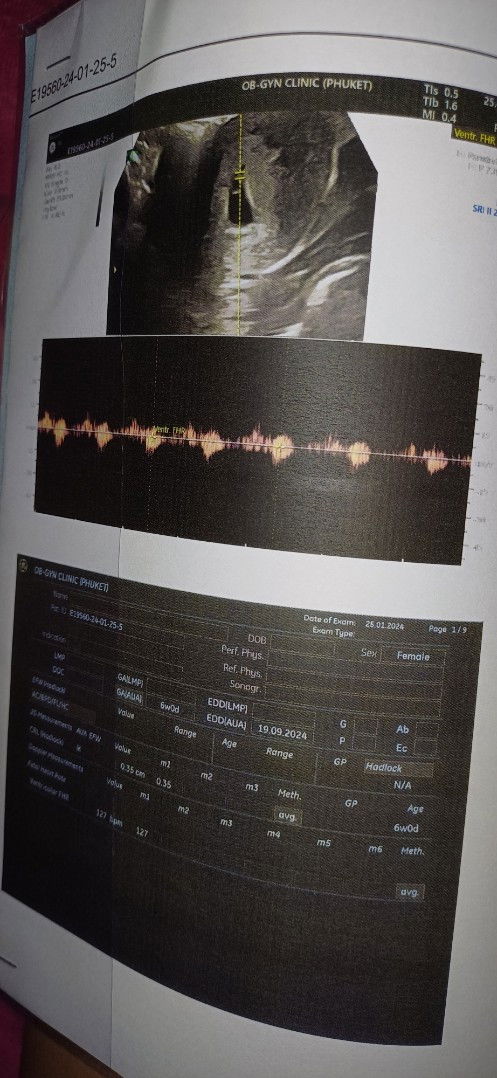 สอบถามหน่อยค่ะท้องแรก