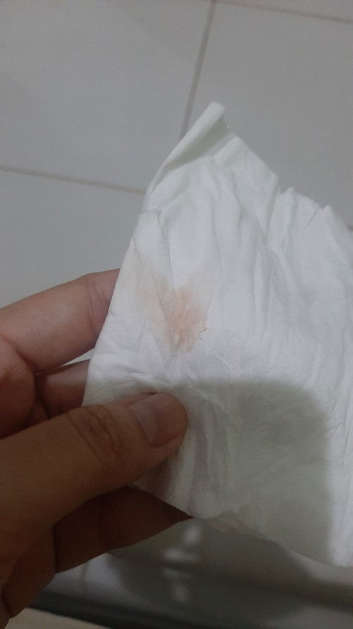 Usia 13w keluar flek