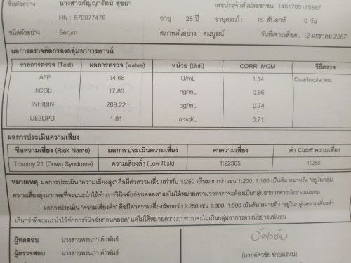 ตรวจคัดกรองดาวน์ซินโดรม