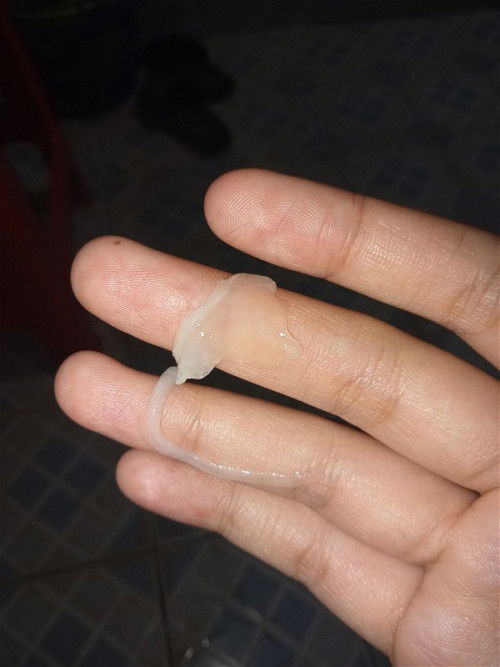 แม่ๆเป็นมูกเยอะกันไหมคะ