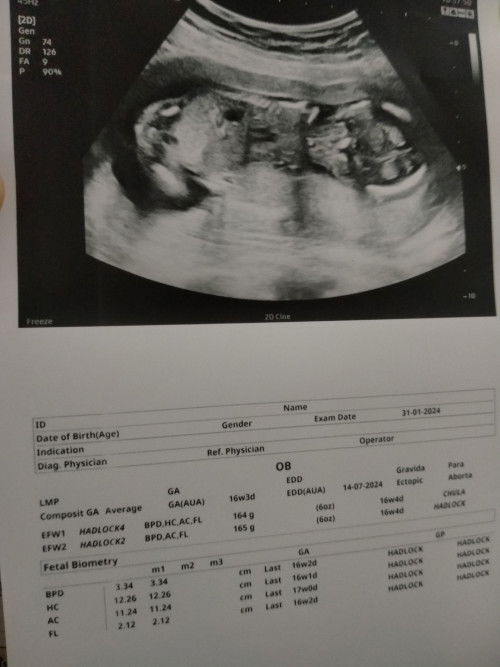 แม่แม่พอจะดูออกไหมค่ะ อัลตร้าซาวด์ทีไร ดูไม่เคยออกสักทีว่าเพศไหน