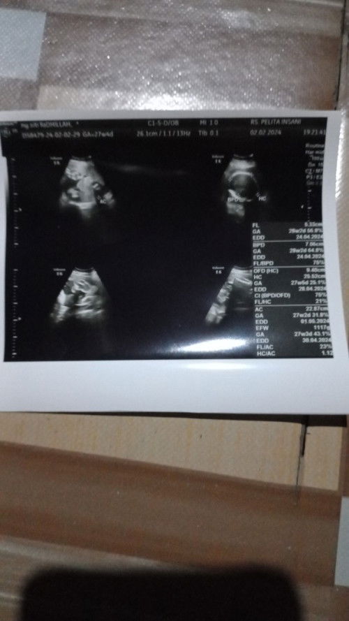 USG usia kehamilan 27W