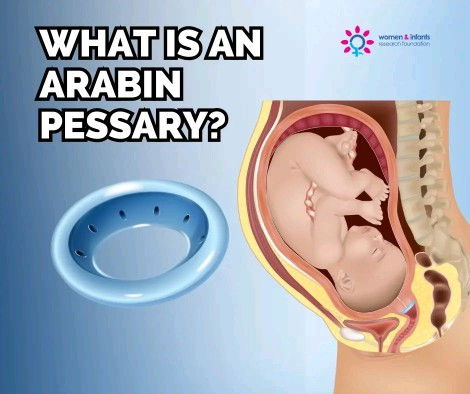 Pessary to prevent preterm labor