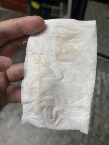 Tentang kehamilan