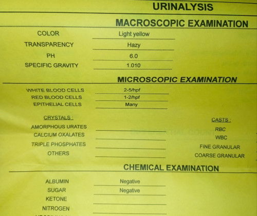 Urinalysis result